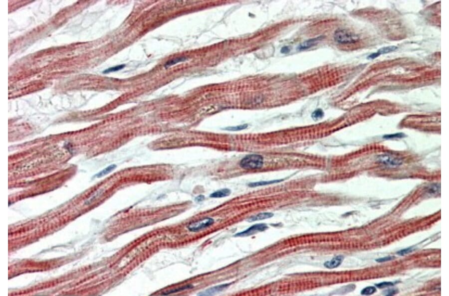 Immunohistochemistry - Anti-EPM2AIP1 Antibody (A84691) - Antibodies.com