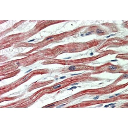 Immunohistochemistry - Anti-EPM2AIP1 Antibody (A84691) - Antibodies.com