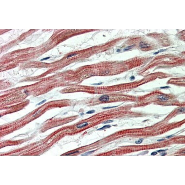 Immunohistochemistry - Anti-EPM2AIP1 Antibody (A84691) - Antibodies.com
