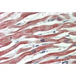 Immunohistochemistry - Anti-EPM2AIP1 Antibody (A84691) - Antibodies.com