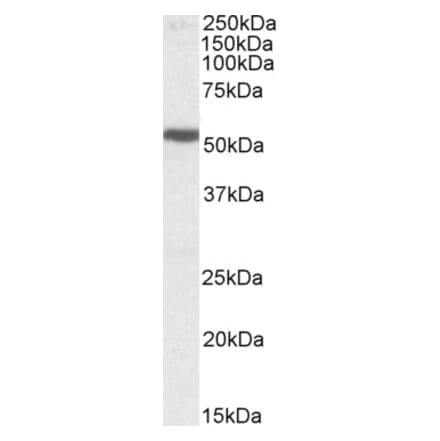 Western Blot - Anti-5HT3B Receptor Antibody (A84693) - Antibodies.com