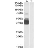Western Blot - Anti-P2X7 Antibody (A84694) - Antibodies.com