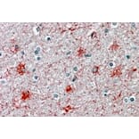Immunohistochemistry - Anti-P2X7 Antibody (A84694) - Antibodies.com