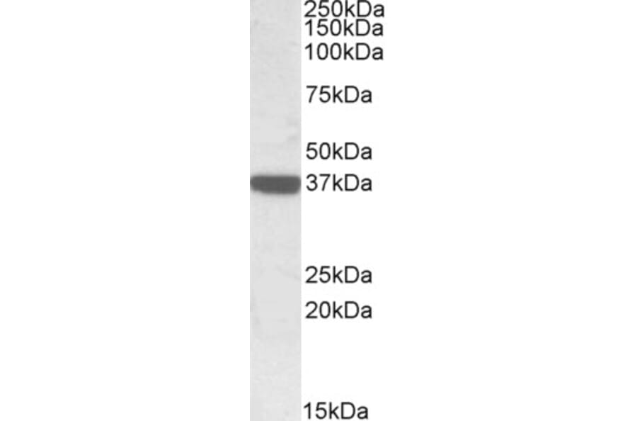 Western Blot - Anti-Calponin 3 Antibody (A84696) - Antibodies.com