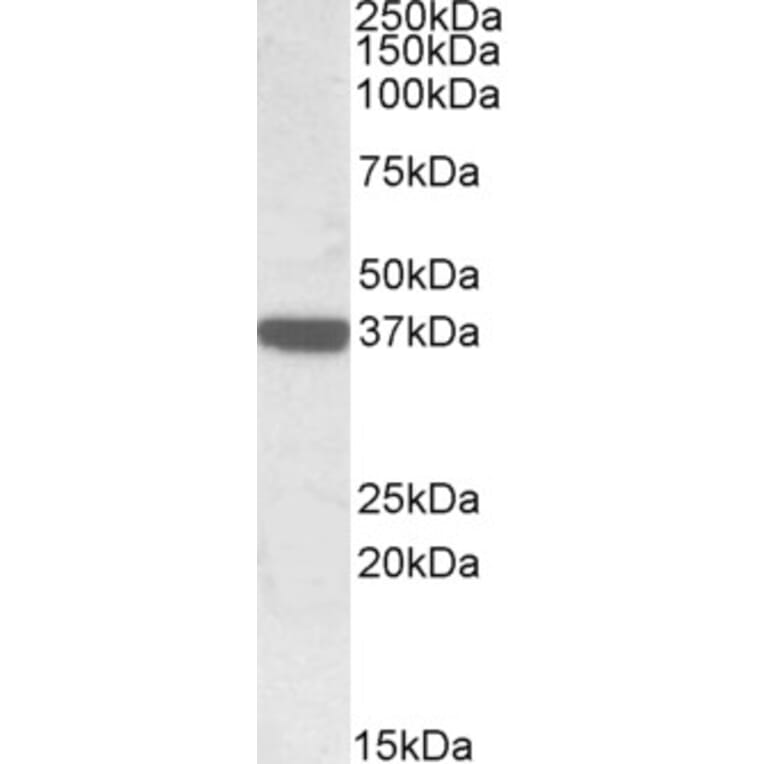 Western Blot - Anti-Calponin 3 Antibody (A84696) - Antibodies.com