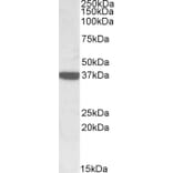 Western Blot - Anti-Calponin 3 Antibody (A84696) - Antibodies.com