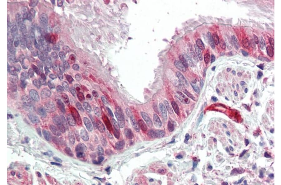 Immunohistochemistry - Anti-Calponin 3 Antibody (A84696) - Antibodies.com
