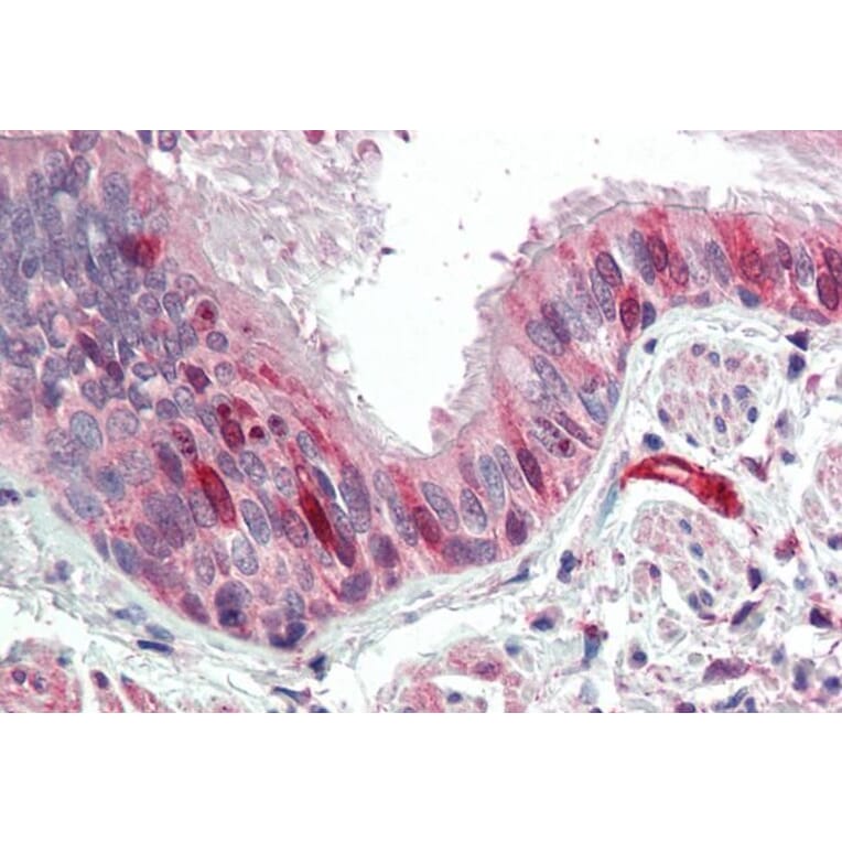 Immunohistochemistry - Anti-Calponin 3 Antibody (A84696) - Antibodies.com