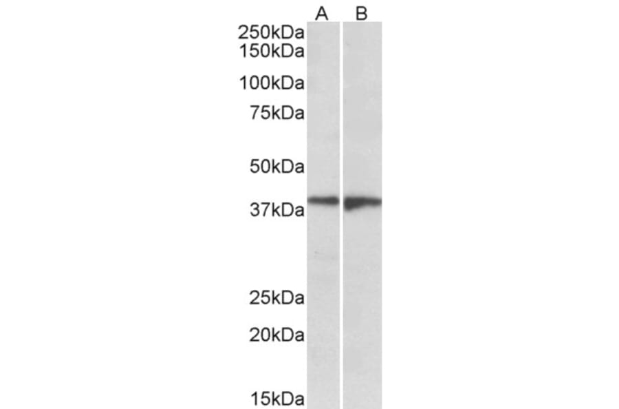 Western Blot - Anti-EDG8 Antibody (A84698) - Antibodies.com