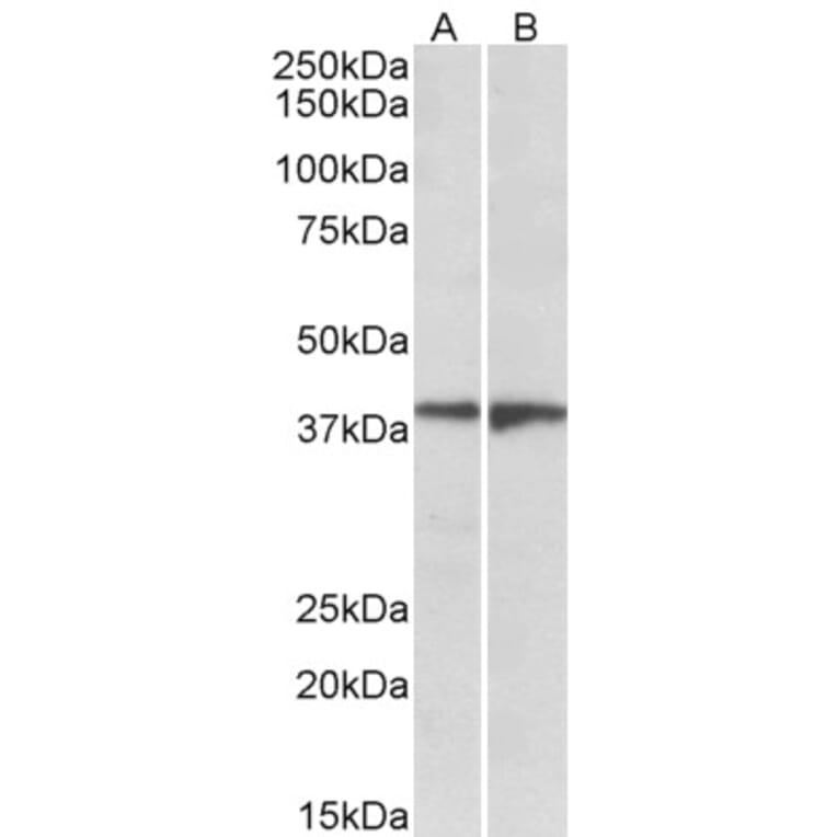 Western Blot - Anti-EDG8 Antibody (A84698) - Antibodies.com