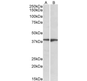Western Blot - Anti-S1PR5 Antibody (A84698) - Antibodies.com