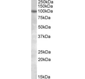 Western Blot - Anti-PKD2 Antibody (A84700) - Antibodies.com