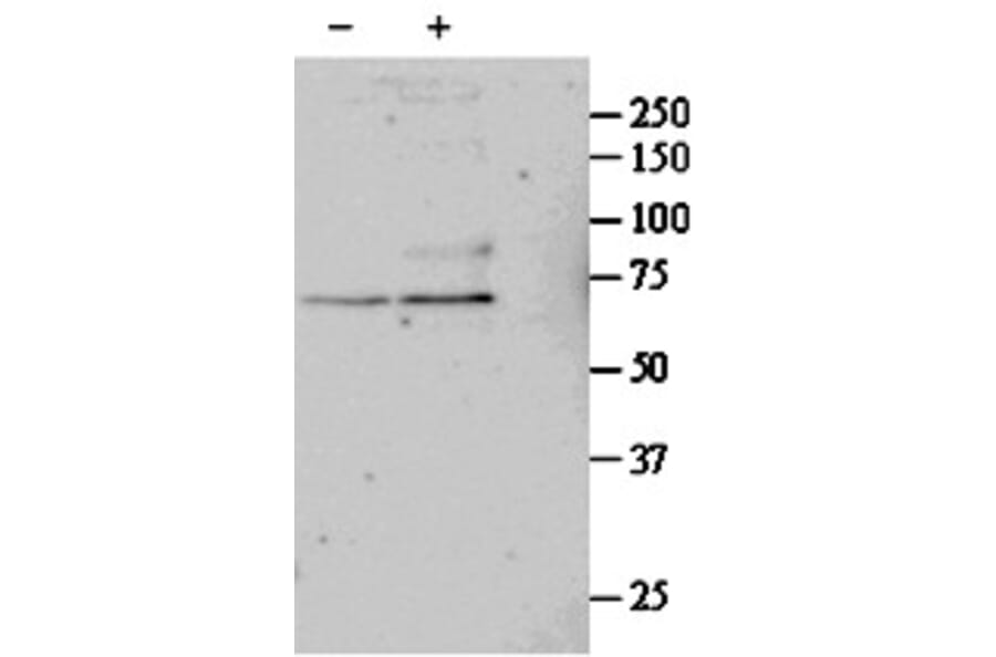 Western Blot - Anti-SRF Antibody (A84701) - Antibodies.com