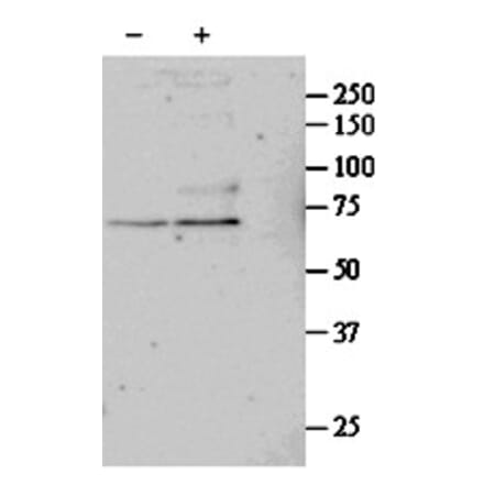 Western Blot - Anti-SRF Antibody (A84701) - Antibodies.com