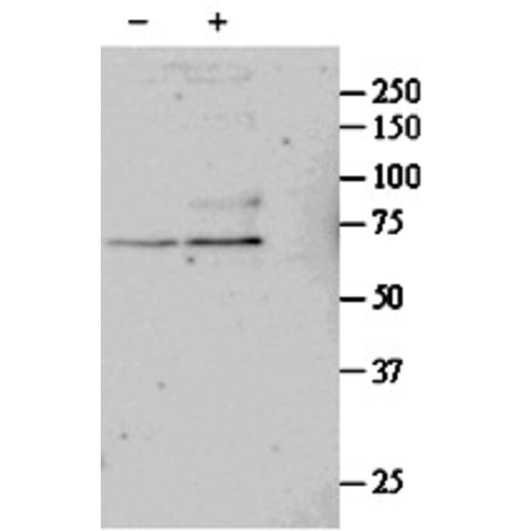 Western Blot - Anti-SRF Antibody (A84701) - Antibodies.com