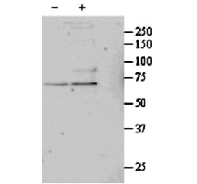 Western Blot - Anti-SRF Antibody (A84701) - Antibodies.com