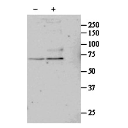 Western Blot - Anti-SRF Antibody (A84701) - Antibodies.com