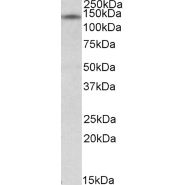 Western Blot - Anti-RIP140 Antibody (A84702) - Antibodies.com