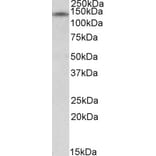 Western Blot - Anti-RIP140 Antibody (A84702) - Antibodies.com