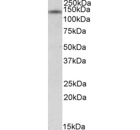 Western Blot - Anti-NRIP1 Antibody (A84702) - Antibodies.com