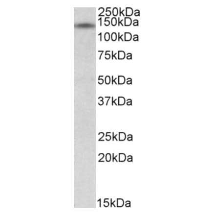 Western Blot - Anti-NRIP1 Antibody (A84702) - Antibodies.com