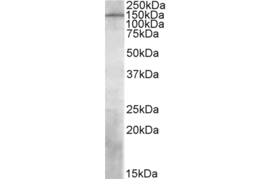 Western Blot - Anti-PREX1 Antibody (A84704) - Antibodies.com