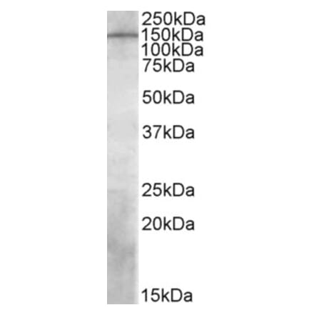 Western Blot - Anti-PREX1 Antibody (A84704) - Antibodies.com