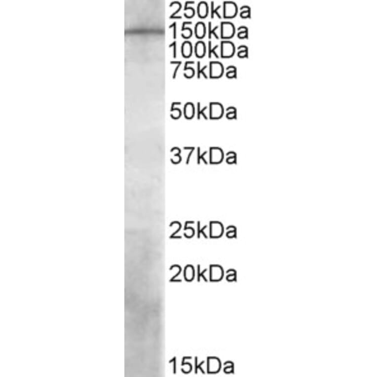 Western Blot - Anti-PREX1 Antibody (A84704) - Antibodies.com