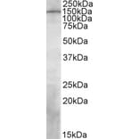 Western Blot - Anti-PREX1 Antibody (A84704) - Antibodies.com