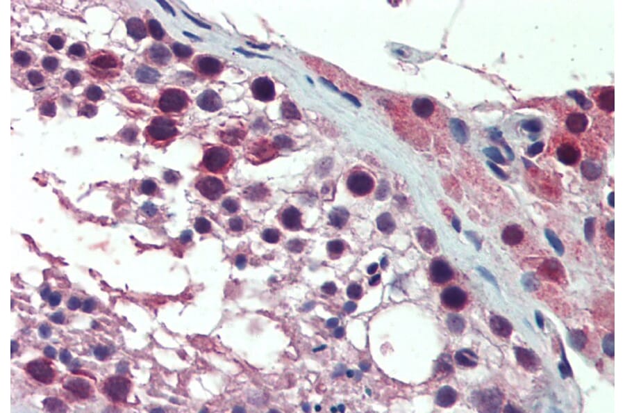 Immunohistochemistry - Anti-PREX1 Antibody (A84704) - Antibodies.com