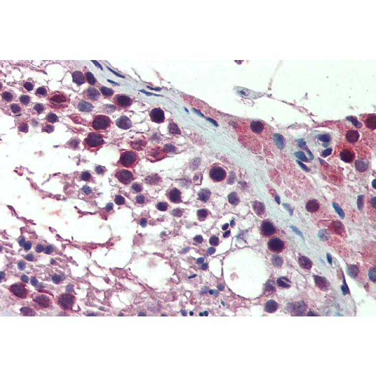 Immunohistochemistry - Anti-PREX1 Antibody (A84704) - Antibodies.com