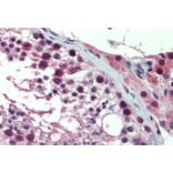 Immunohistochemistry - Anti-PREX1 Antibody (A84704) - Antibodies.com