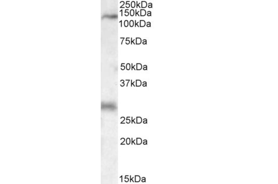 Western Blot - Anti-MAP3K6 Antibody (A84705) - Antibodies.com