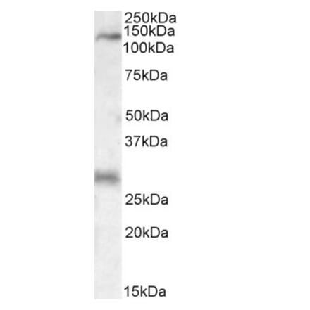 Western Blot - Anti-MAP3K6 Antibody (A84705) - Antibodies.com