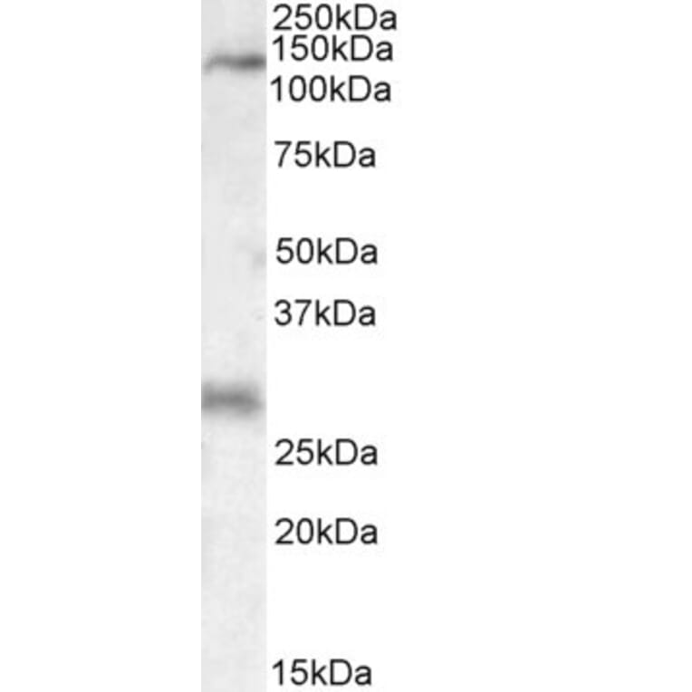 Western Blot - Anti-MAP3K6 Antibody (A84705) - Antibodies.com