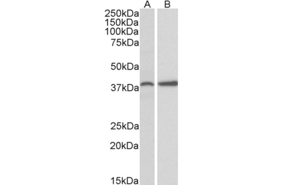 Western Blot - Anti-SRBC Antibody (A84707) - Antibodies.com