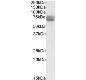 Western Blot - Anti-TPP1 Antibody (A84708) - Antibodies.com
