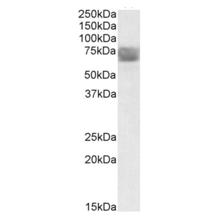 Western Blot - Anti-TPP1 Antibody (A84708) - Antibodies.com
