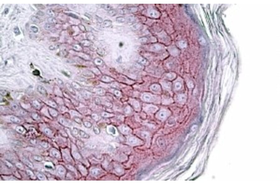 Immunohistochemistry - Anti-Desmoglein 1/DSG1 Antibody (A84710) - Antibodies.com