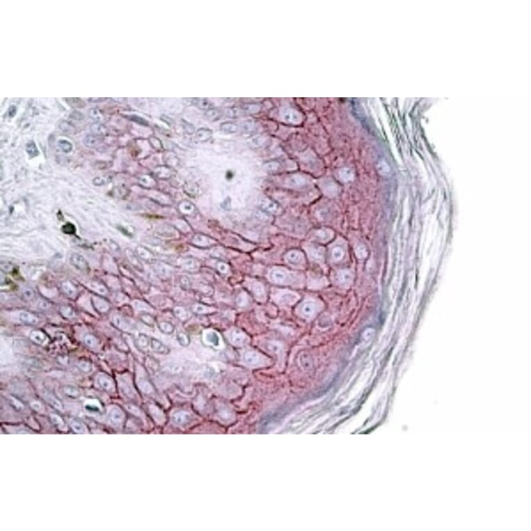 Immunohistochemistry - Anti-Desmoglein 1/DSG1 Antibody (A84710) - Antibodies.com