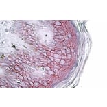 Immunohistochemistry - Anti-Desmoglein 1/DSG1 Antibody (A84710) - Antibodies.com