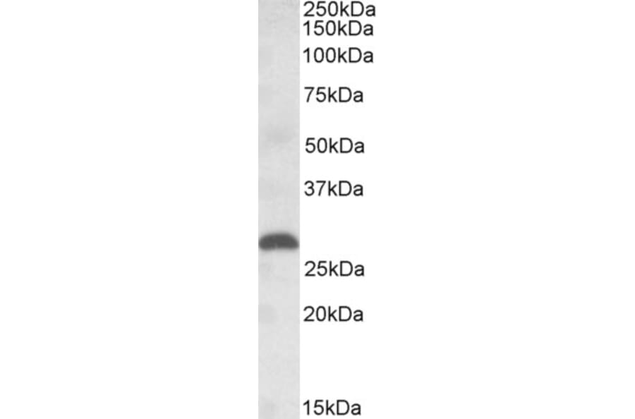 Western Blot - Anti-PGF Antibody (A84713) - Antibodies.com