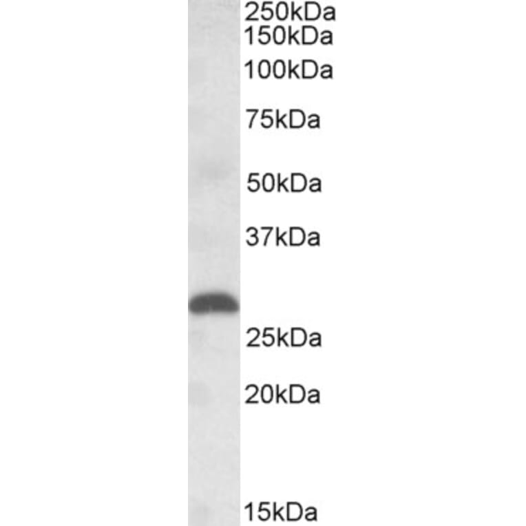 Western Blot - Anti-PGF Antibody (A84713) - Antibodies.com
