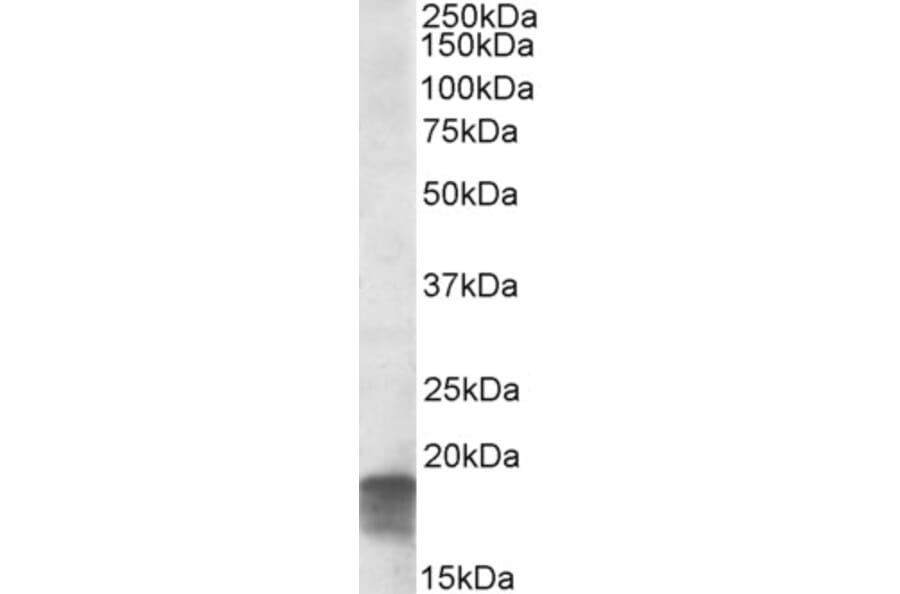 Western Blot - Anti-SDHAF1 Antibody (A84714) - Antibodies.com