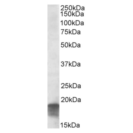 Western Blot - Anti-SDHAF1 Antibody (A84714) - Antibodies.com