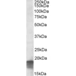Western Blot - Anti-SDHAF1 Antibody (A84714) - Antibodies.com
