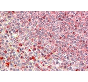 Immunohistochemistry - Anti-UBR4 Antibody (A84716) - Antibodies.com