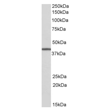 Western Blot - Anti-TRIB1 Antibody (A84718) - Antibodies.com