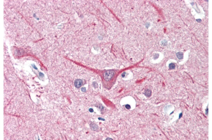 Immunohistochemistry - Anti-UBR2 Antibody (A84720) - Antibodies.com