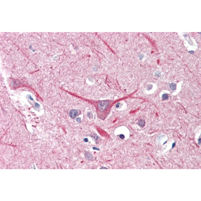 Immunohistochemistry - Anti-UBR2 Antibody (A84720) - Antibodies.com